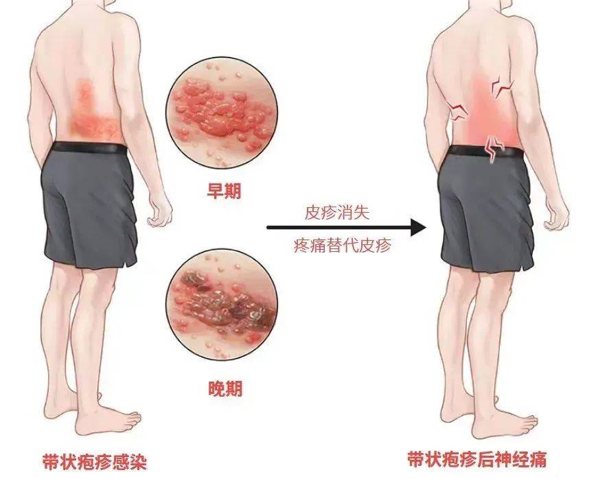 一旦感染终身携带<strong></p>
<p>以太行情</strong>！深圳疾控提醒：这4类人要注意