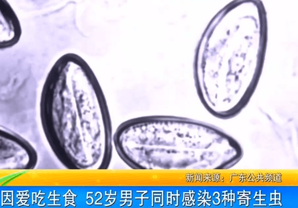 女子体内排出10米长绦虫<strong></p>
<p>binance币安下载</strong>！原是两年前旅游时吃了这种食物
