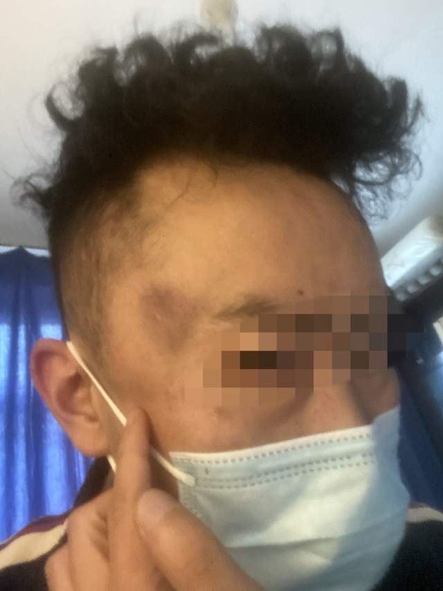 母亲未做核酸遭民警责骂<strong></p>
<p>币安binance网</strong>，男子插话后被群殴，涉案3名警员公开受审