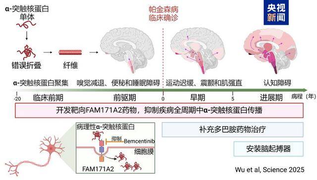 全球首次<strong></p>
<p>币安下载</strong>！复旦大学科研团队发现帕金森病全新治疗靶点