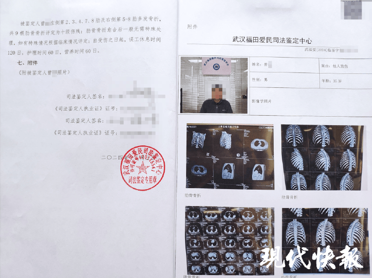 湖北一男子称被交警打断9根肋骨未立案<strong></p>
<p>耐克</strong>，警方回应