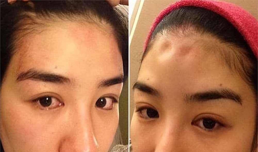 罗霖被家暴17年<strong></p>
<p>摘取okex技术指标</strong>，蓝洁瑛遭性侵暴力还被围观！女明星的暴力事件还有很多